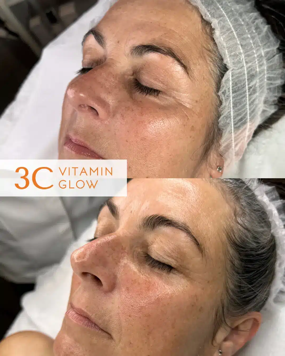 3C Rozžiarujúce ošetrenie pleti s trojitým vit C – Obrázok 13