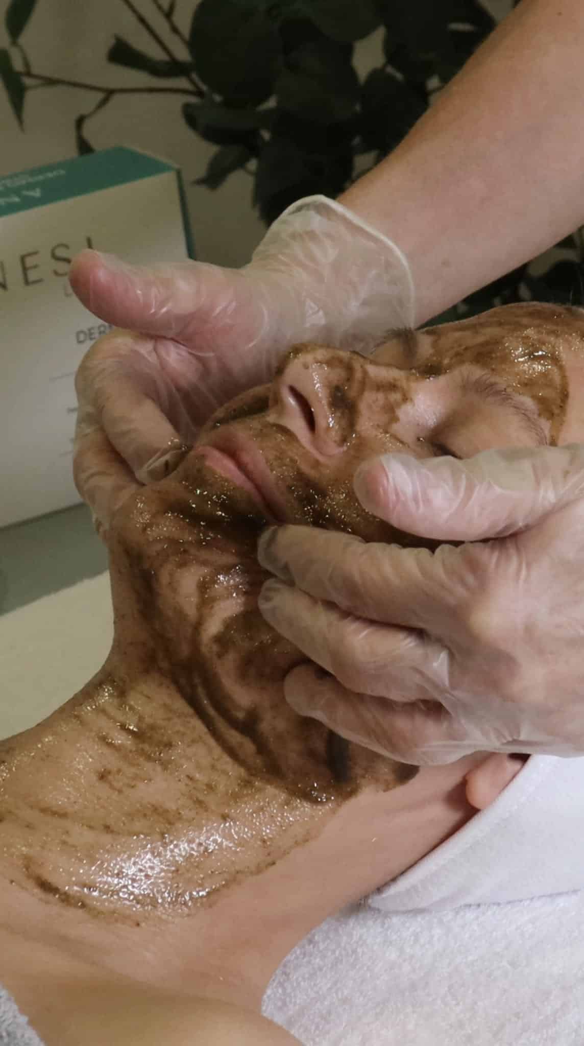 Bio-microneedling Dermo Peel so spikulami RENEWAL Nº3 – Obrázok 3
