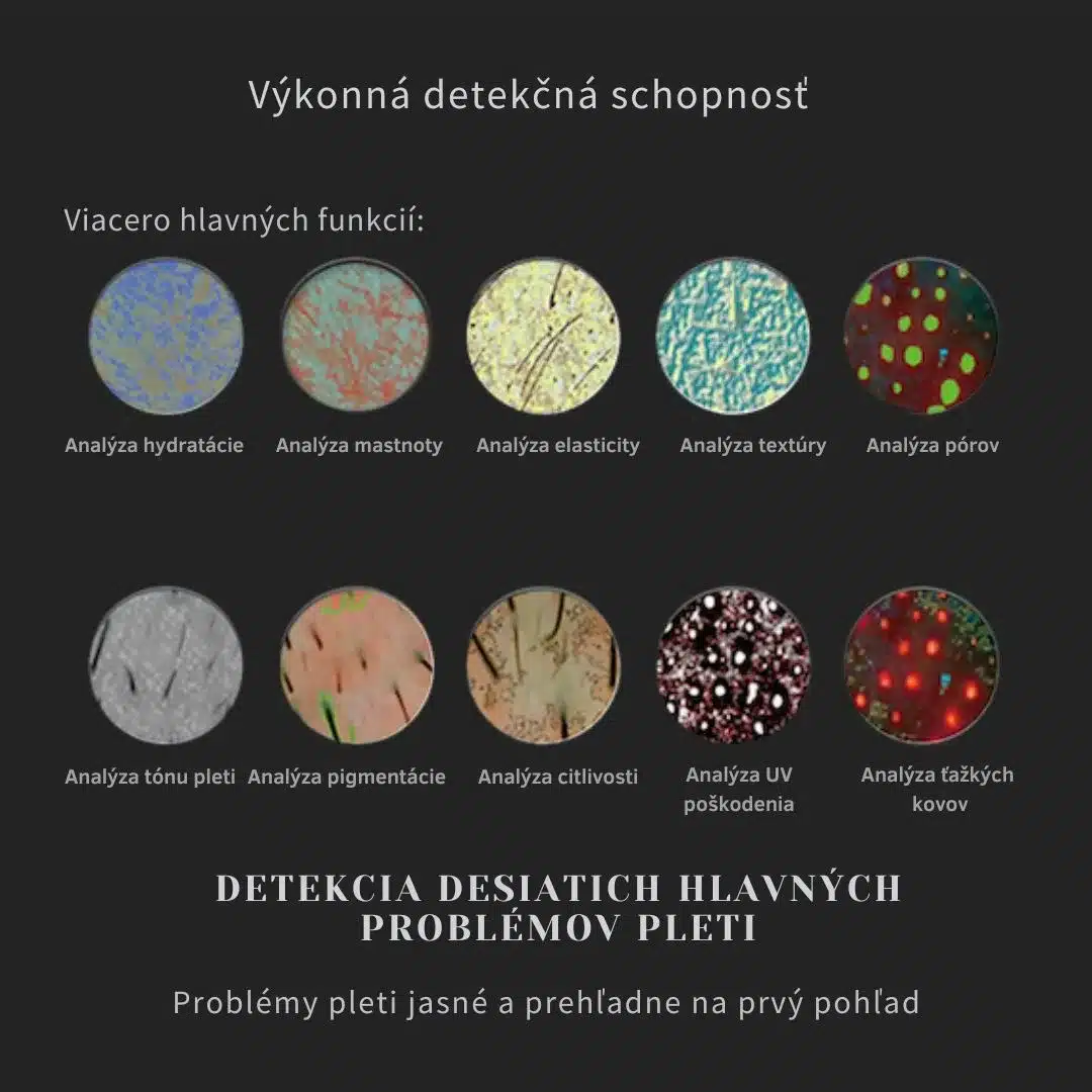 3D analyzátor pleti – Obrázok 5